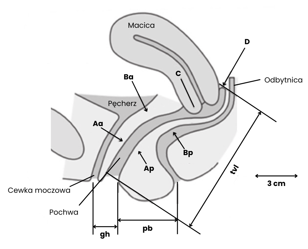 system popQ